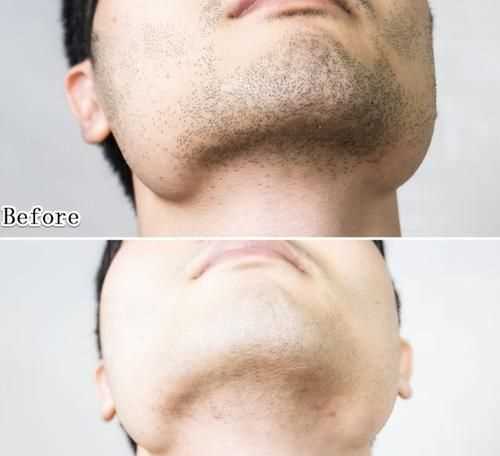 青春期的男生長胡子是刮還是剪為好