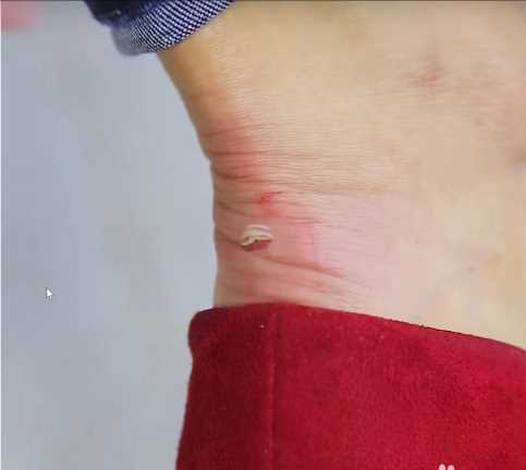 鞋子磨腳后跟要怎么處理鞋子