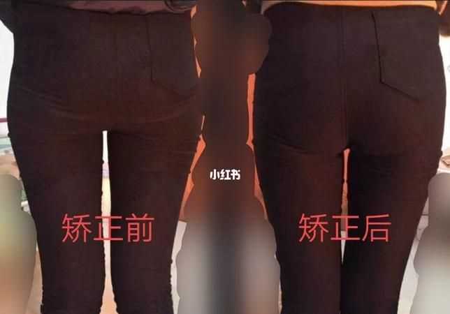 假胯寬的人應(yīng)該如何鍛煉和矯正走路姿勢視頻