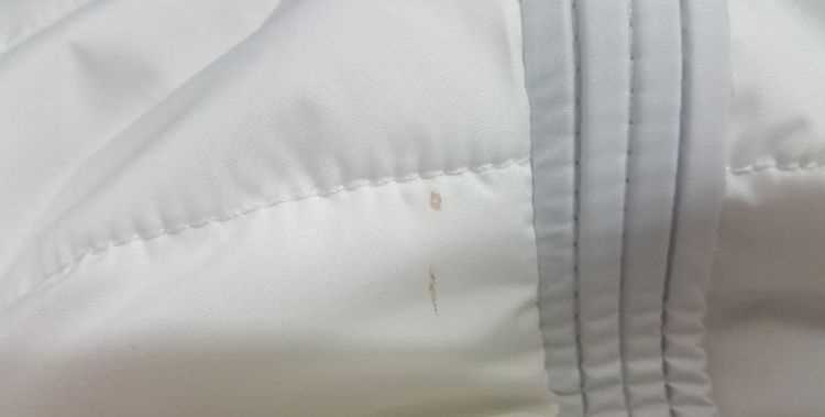 衣服上有血跡怎么辦