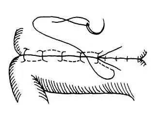 動(dòng)物腸管縫合的方法有哪些