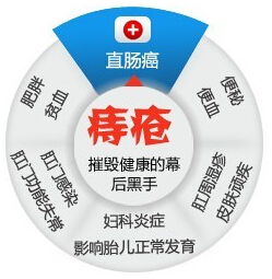 快速治療痔瘡小方法有哪些方法