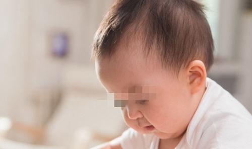 新生兒,注意事項(xiàng),前三天