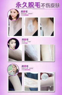 脫毛,迪斯,注意事項(xiàng)