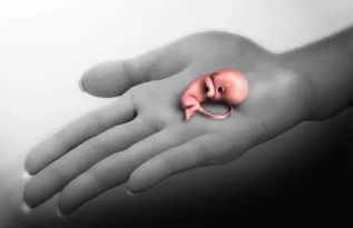 子宮破裂術(shù)后注意事項,子宮破裂修補術(shù)后注意事項,為預(yù)防子宮破裂手術(shù)注意事項不包括