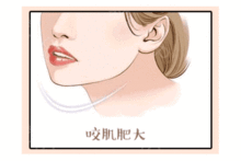 微整形術后注意事項