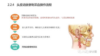 血?dú)?標(biāo)本,時(shí)應(yīng),注意事項(xiàng)