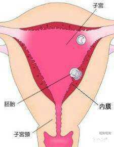 試管宮腔鏡手術(shù)后注意事項,宮腔鏡后注意事項和飲食注意,宮腔鏡手術(shù)后注意事項