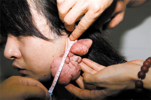 注意事項(xiàng),穿耳洞