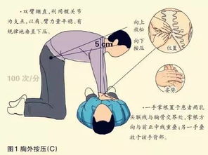 簡述胸外按壓注意事項