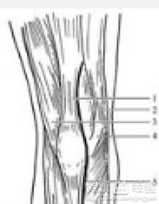 肌腱,斷裂,修補(bǔ),注意事項(xiàng)