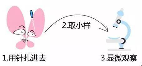 宮頸hpv檢查前注意事項