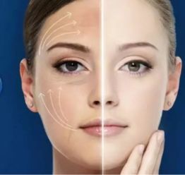 v臉提升注意事項