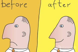 隆鼻,濟(jì)南,修復(fù),注意事項(xiàng)