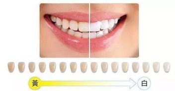 beyond冷光美白注意事項