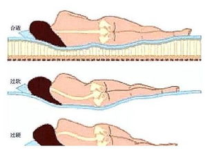 腰膨出注意事項(xiàng)