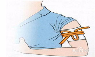 止血帶,應注意,事項