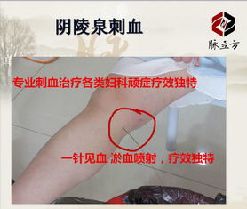 火針療法的禁忌癥及注意事項(xiàng),刺血療法的注意事項(xiàng)及禁忌癥,刺血療法后的注意事項(xiàng)